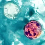 The Cyclospora Crisis: Dissecting the Intersection of Public Health, Politics, and Parasitology