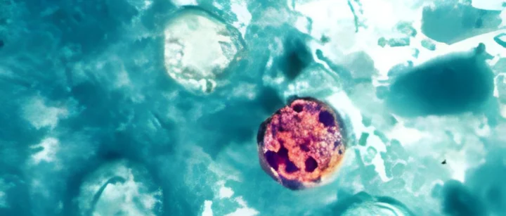 The Cyclospora Crisis: Dissecting the Intersection of Public Health, Politics, and Parasitology